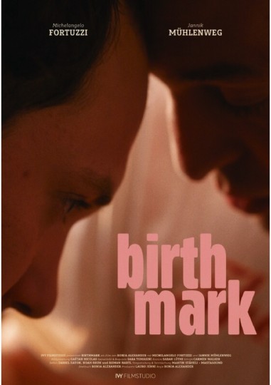 Birthmark